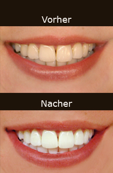 Praxis Zurdentalhygiene Petra Groskova