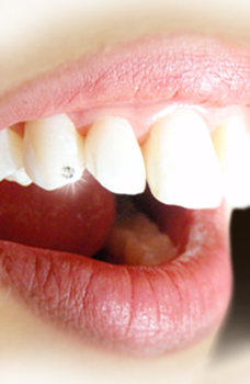 Praxis Zurdentalhygiene Petra Groskova