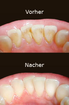 Praxis Zurdentalhygiene Petra Groskova